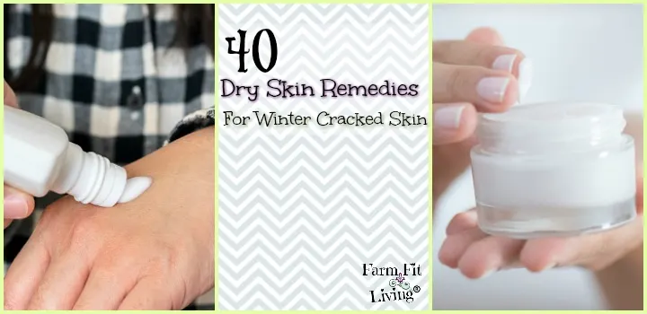 Dry Skin Remedies for Winter Cracked Skin