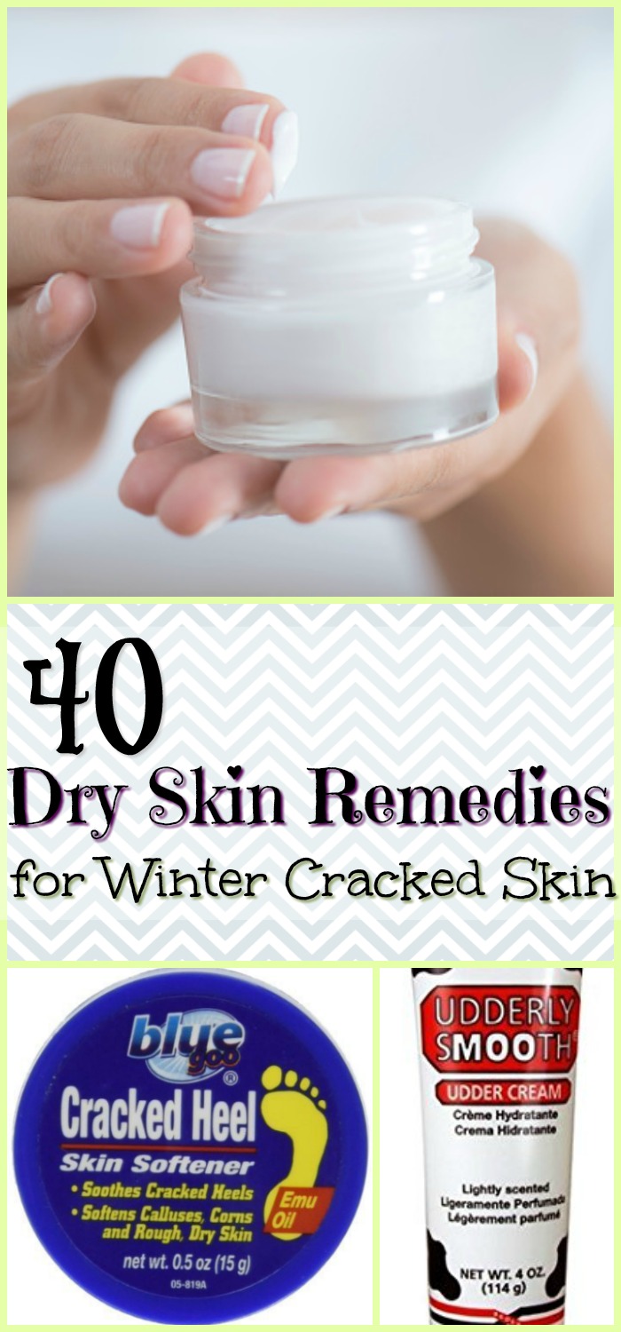 40 Dry Skin Remedies for Winter Cracked Skin | Farm Fit Living